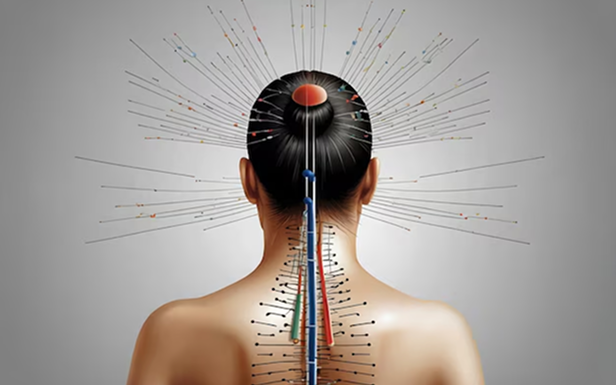 Acupuncture Therapy